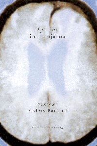 Fjärilen i min hjärna
